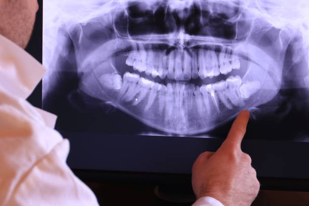 Best Emergency Broken Tooth Repair in Bowling Green, FL